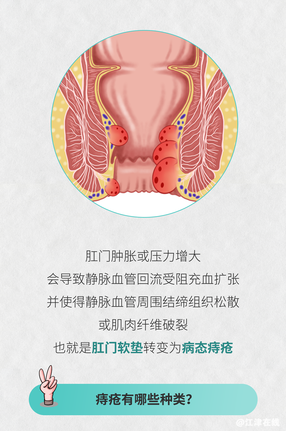 b18656627a11732877d63216b0569189.png