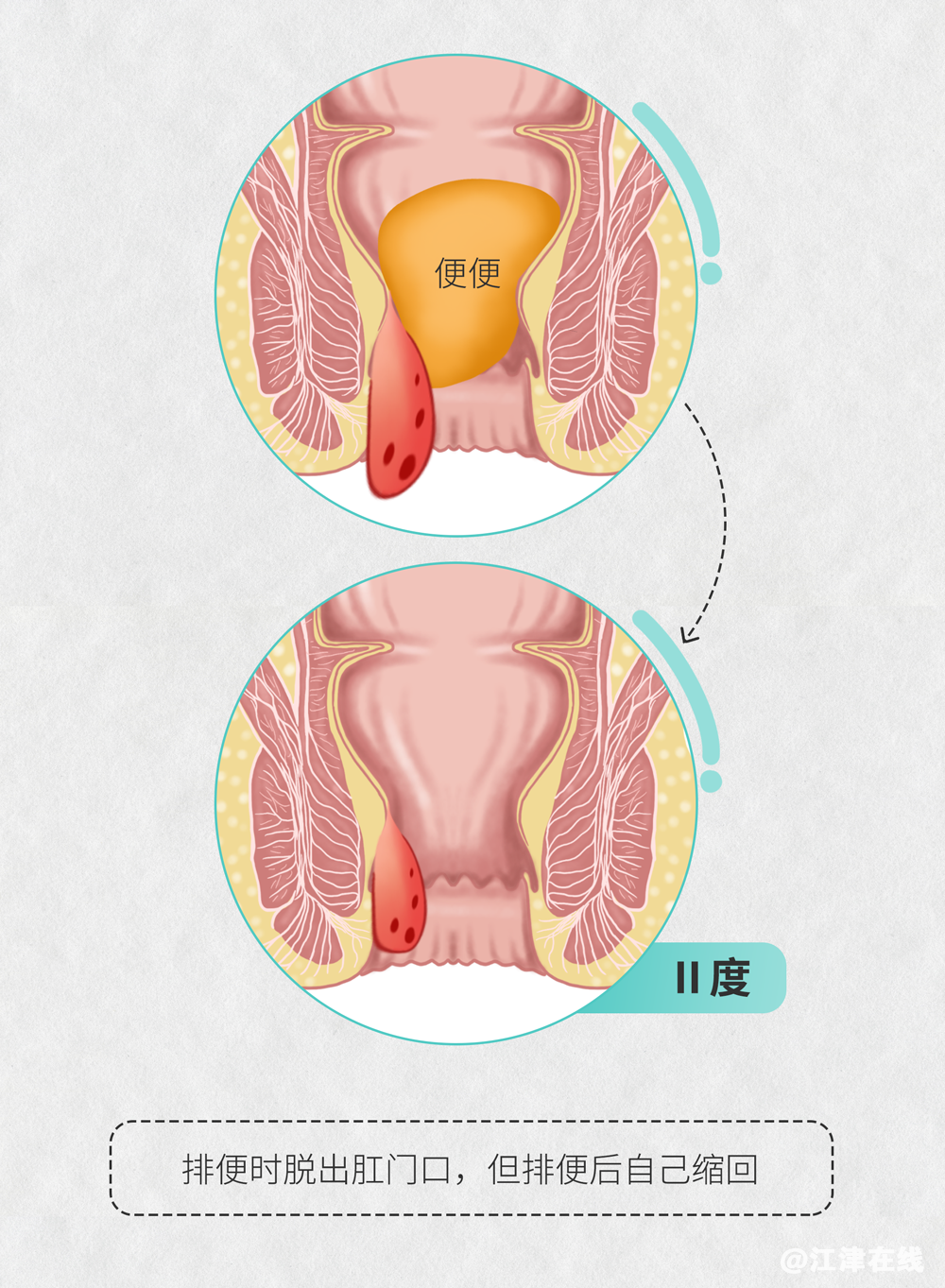 aabe34eceeb6333dc1da288545f47dfb.png