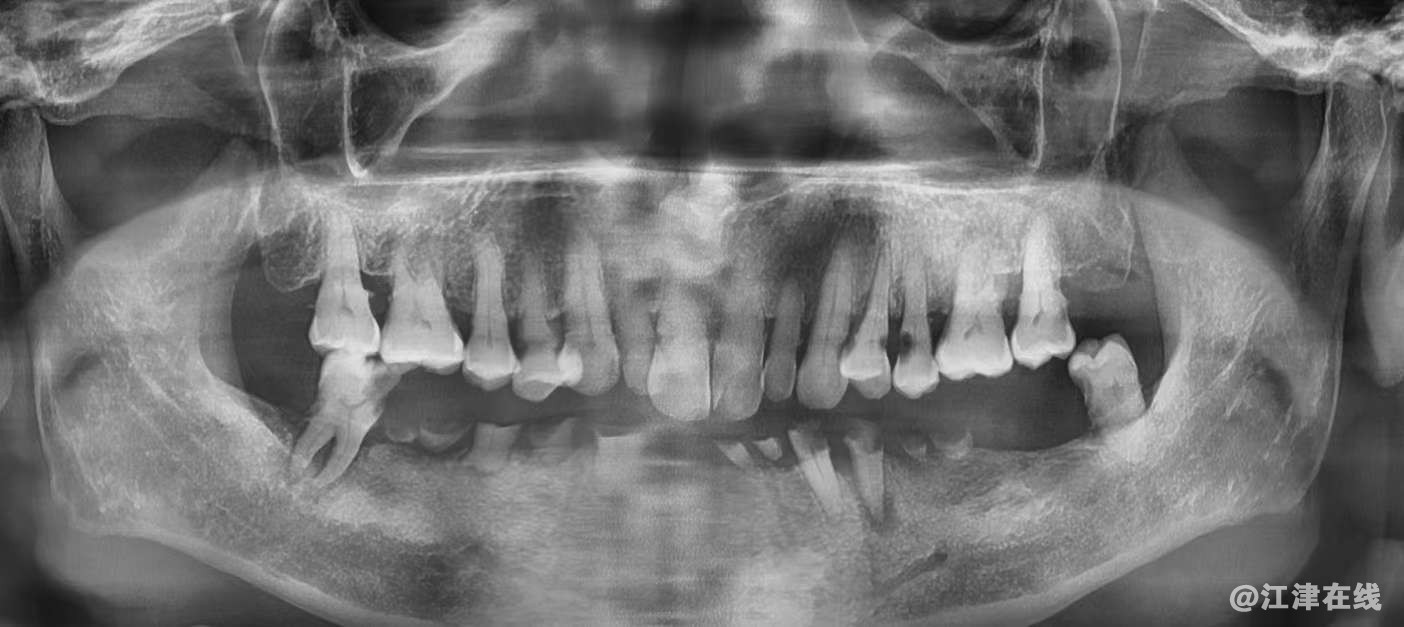 20211226113451front2_0_417755_Fr4BX2KS6nR-sDHQ7odvL0DuBc9d.jpg